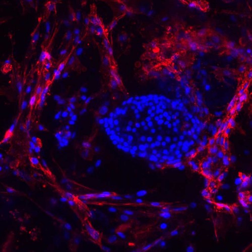 Photo of Stemming the Tide of Immune Response