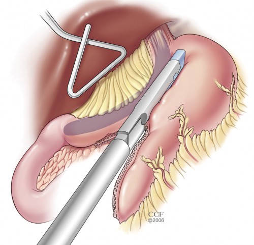 Photo of Mending Metabolism