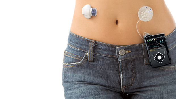 Photo of Is Medtronic’s MiniMed 640G an Artificial Pancreas?
