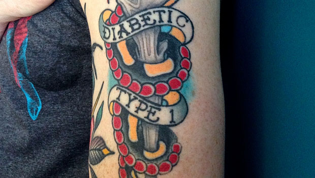 Photo of 6 Tattooing Tips for People With Type 1
