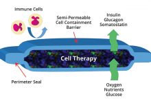 Photo of Will ViaCyte&rsquo;s Encaptra Cell Delivery System &lsquo;Cure&rsquo; Type 1 Diabetes?