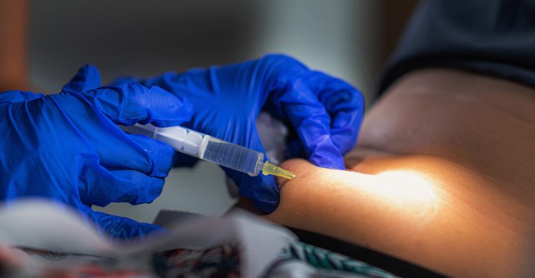 Photo of Subcutaneous Islet Transplant Provides Safer, Efficient Path for Type 1 Cure
